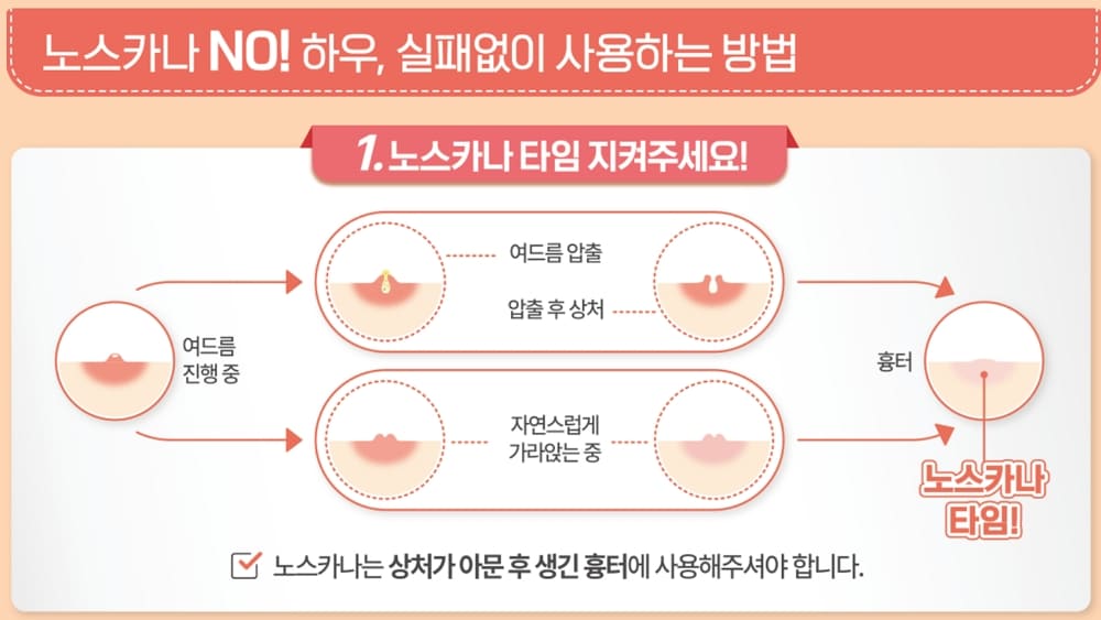 노스카나 사용시기